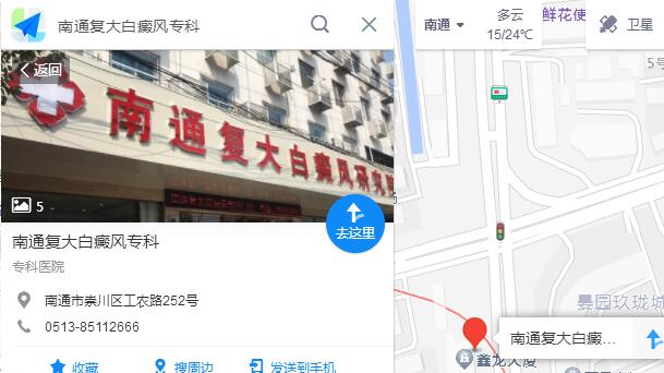 南通白癜风医院路线